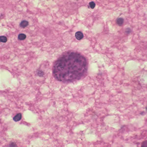 Toxoplasma gondii